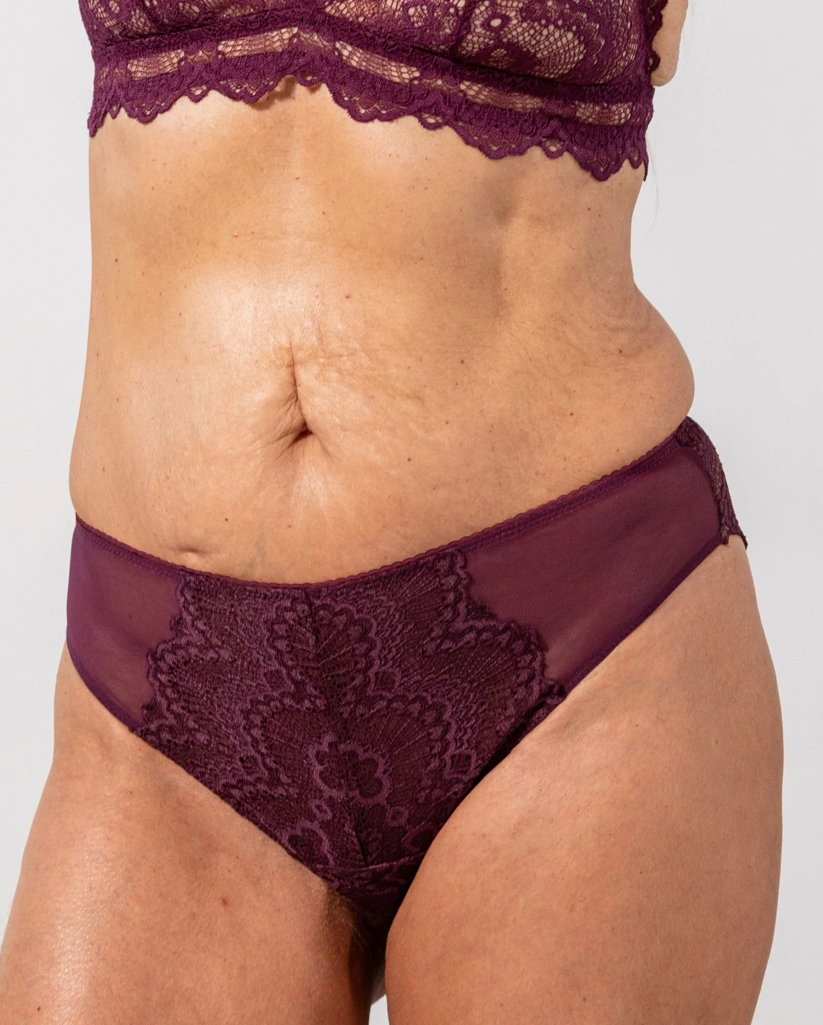 Lace Cheeky Cherry - Image 9