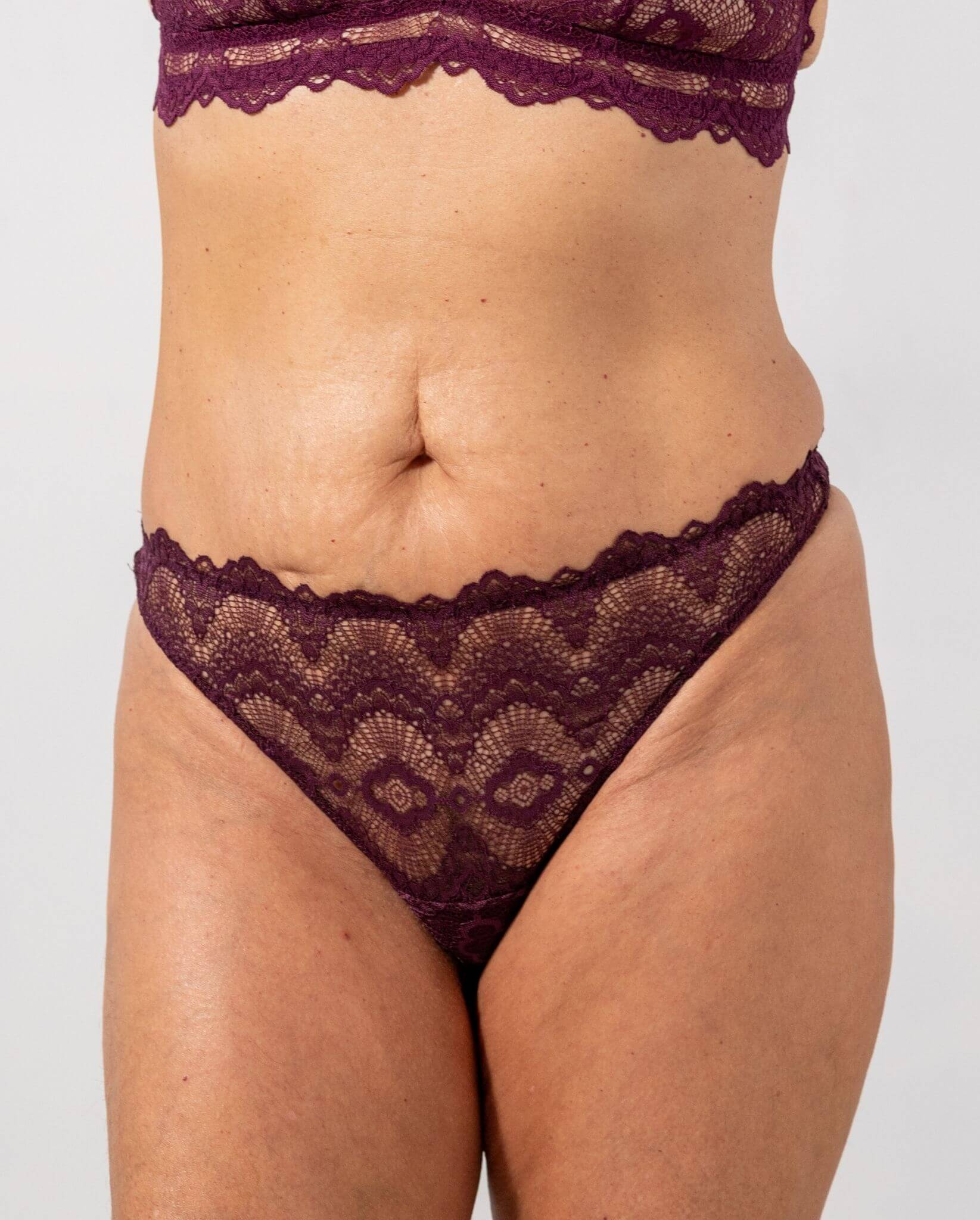 Lace Thong Cherry - Image 5
